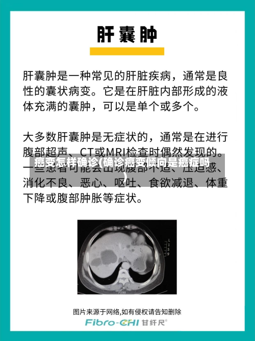 癌变怎样确诊(确诊癌变倾向是癌症吗)