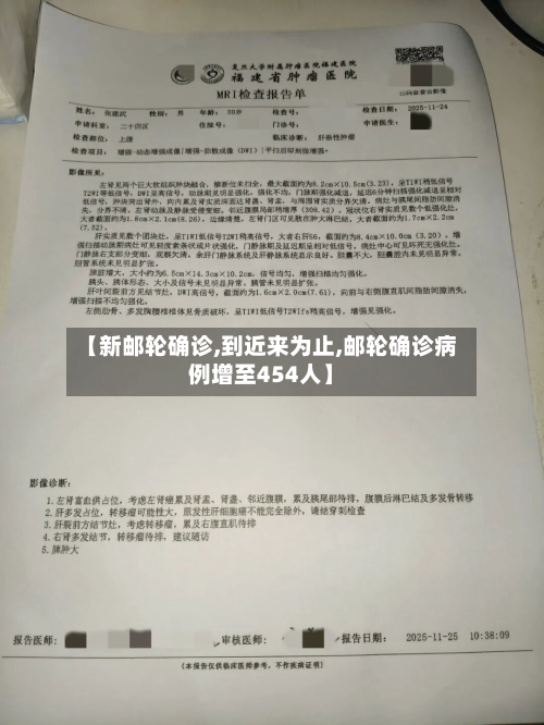 【新邮轮确诊,到近来为止,邮轮确诊病例增至454人】