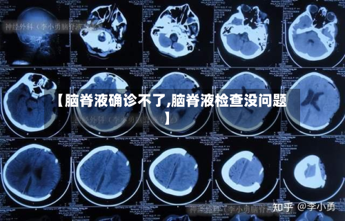 【脑脊液确诊不了,脑脊液检查没问题】