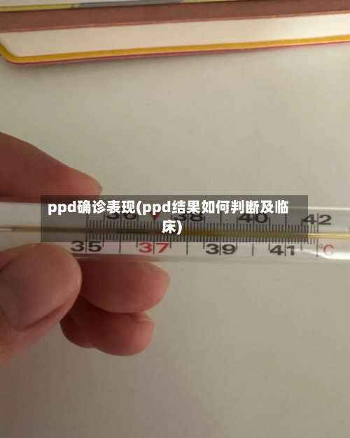 ppd确诊表现(ppd结果如何判断及临床)