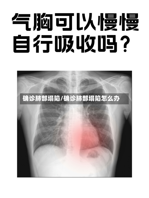 确诊肺部塌陷/确诊肺部塌陷怎么办