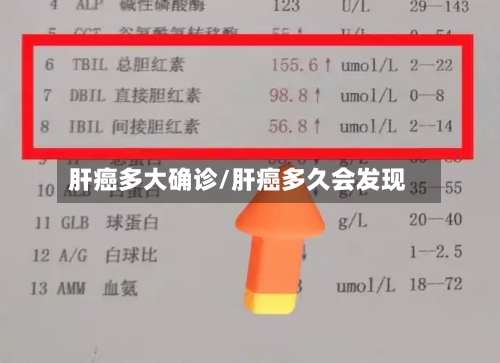 肝癌多大确诊/肝癌多久会发现