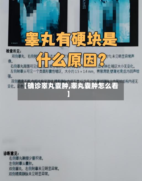 【确诊睾丸囊肿,睾丸囊肿怎么看】