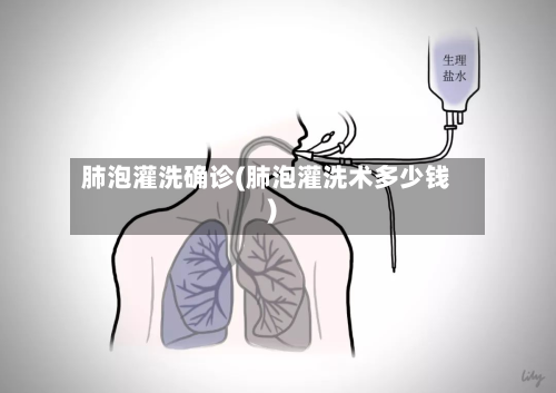 肺泡灌洗确诊(肺泡灌洗术多少钱)