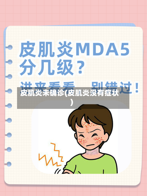 皮肌炎未确诊(皮肌炎没有症状)-第2张图片
