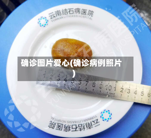 确诊图片爱心(确诊病例照片)