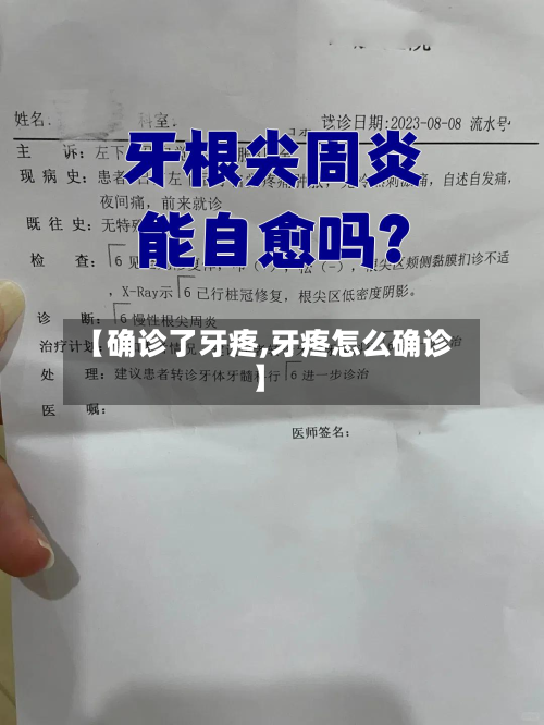 【确诊了牙疼,牙疼怎么确诊】-第3张图片