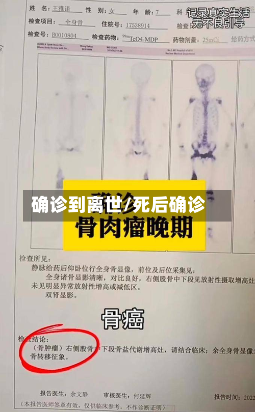 确诊到离世/死后确诊-第3张图片