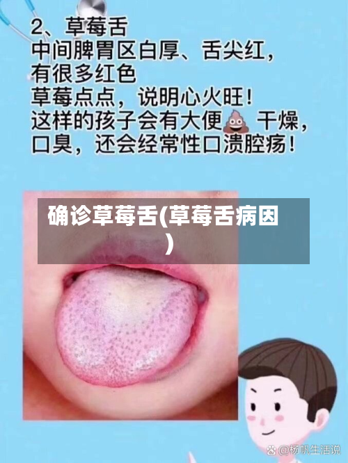 确诊草莓舌(草莓舌病因)