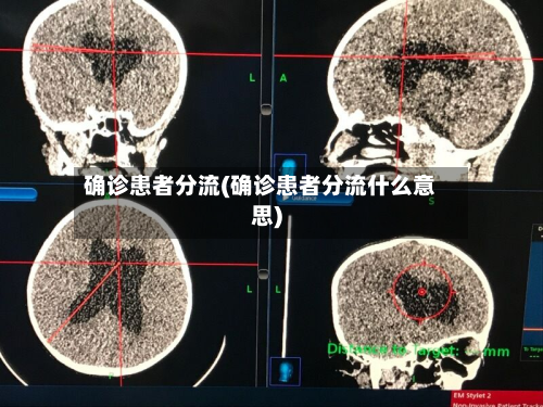 确诊患者分流(确诊患者分流什么意思)