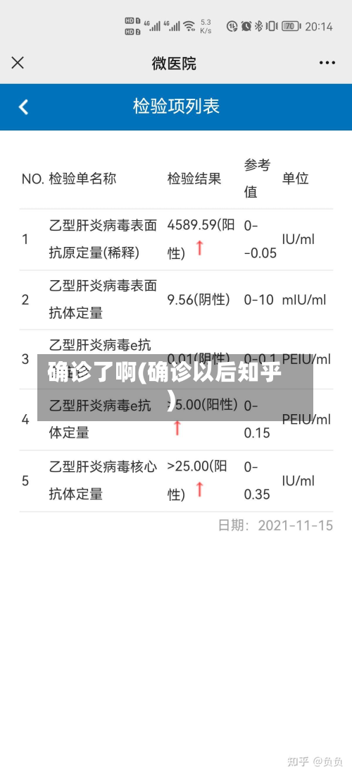 确诊了啊(确诊以后知乎)-第3张图片