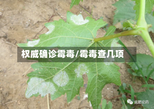 权威确诊霉毒/霉毒查几项