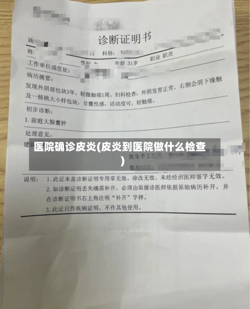医院确诊皮炎(皮炎到医院做什么检查)