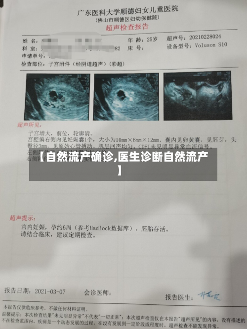 【自然流产确诊,医生诊断自然流产】