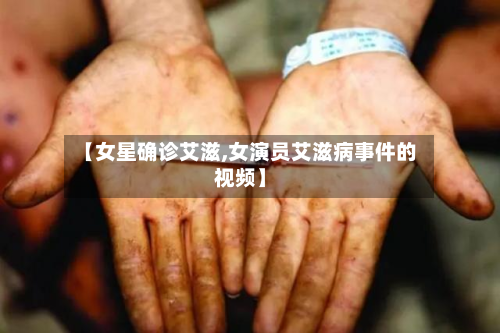 【女星确诊艾滋,女演员艾滋病事件的视频】